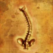 Mental 2: Spine